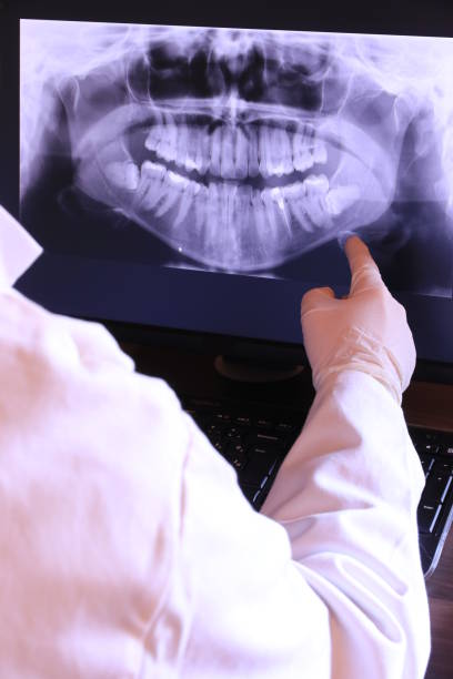 Teeth Whitening in TX
