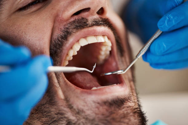Best Tooth Infection Emergency Dentist  in Santa Rita Ranch, TX